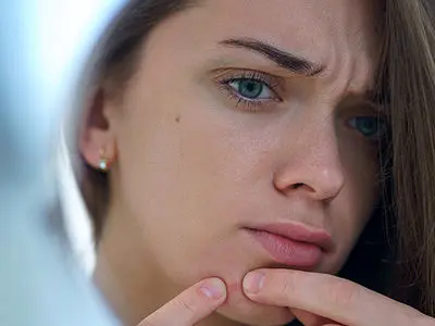 عادت‌هایی که باعث تشدید جوش‌های صورت می‌شوند