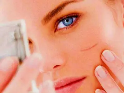 از بین بردن جای زخم و بخیه با روش های خانگی