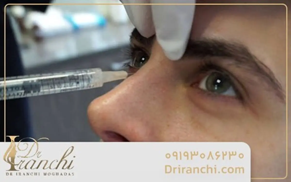 چرا تزریق فیلر بینی در تهران محبوب شده است؟