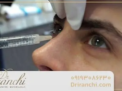 چرا تزریق فیلر بینی در تهران محبوب شده است؟