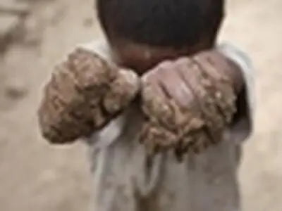 یک کارگر ۹ ساله حین انجام کار دچار حادثه شد