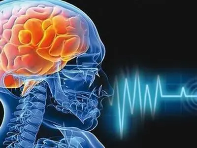 اگر پولدار باشید ۳۰ درصد شانس بیشتری برای زنده ماندن بعد از سکته مغزی را دارید