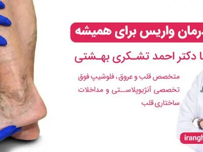 درمان واریس برای همیشه | بهترین راه درمان واریس 