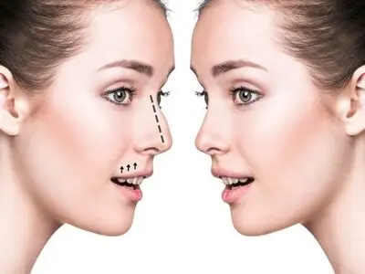 جراحی بینی در ایلام؛ راز چهره‌ای جذاب و زیبا