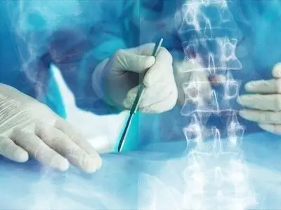 جراحی لامینکتومی دیسک کمر چگونه انجام میشود؟