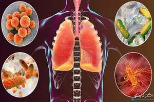 اعلام نتایج یک مطالعه جدید و مهم درباره کپک خانگی 