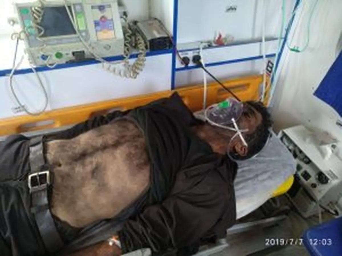 مسمومیت یک کارگر معدن کیاسر بر اثر گازگرفتگی 