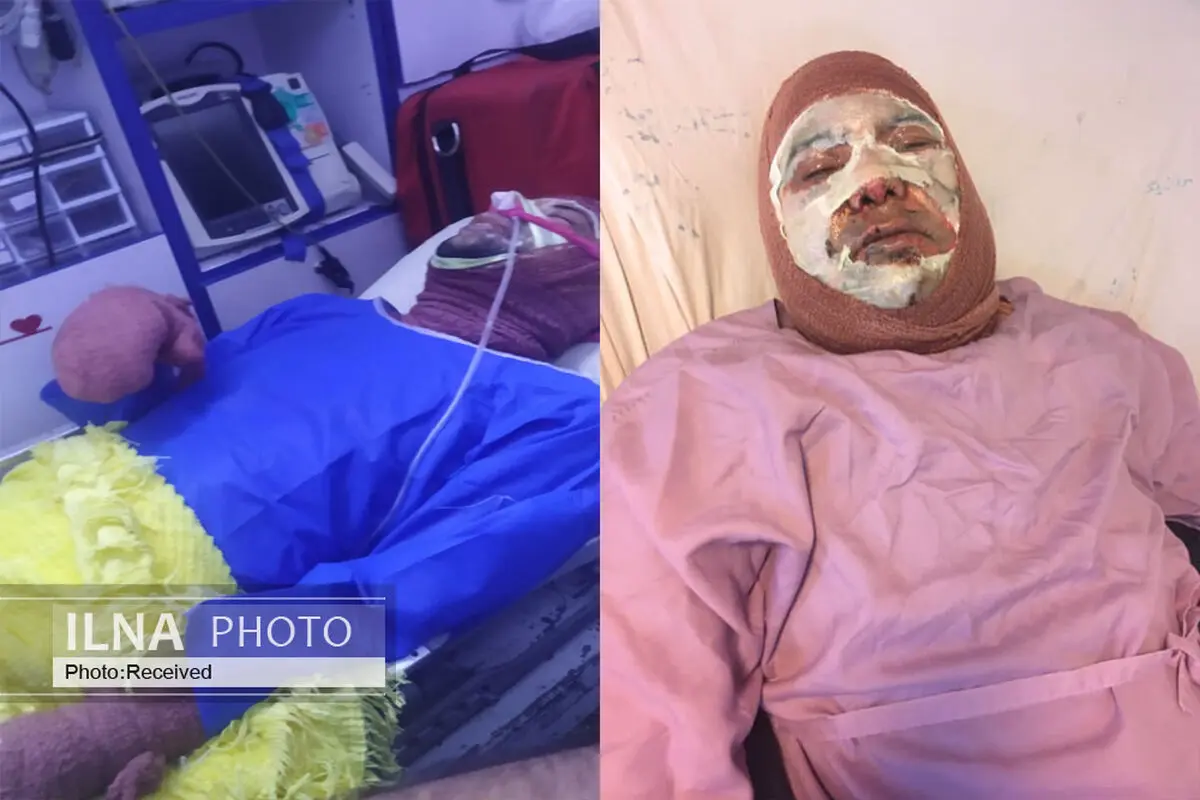 آتش‌سوزی در آزمایشگاه پردیس ابوریحان دانشگاه تهران/ سوختگی یک دانشجو و کارشناس آزمایشگاه 