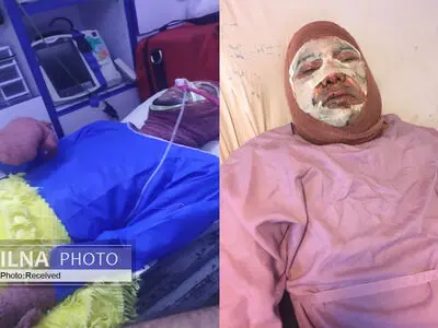 آتش‌سوزی در آزمایشگاه پردیس ابوریحان دانشگاه تهران/ سوختگی یک دانشجو و کارشناس آزمایشگاه 