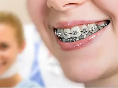 بهترین متخصص ارتودنسی کیست و چه ویژگی هایی دارد؟