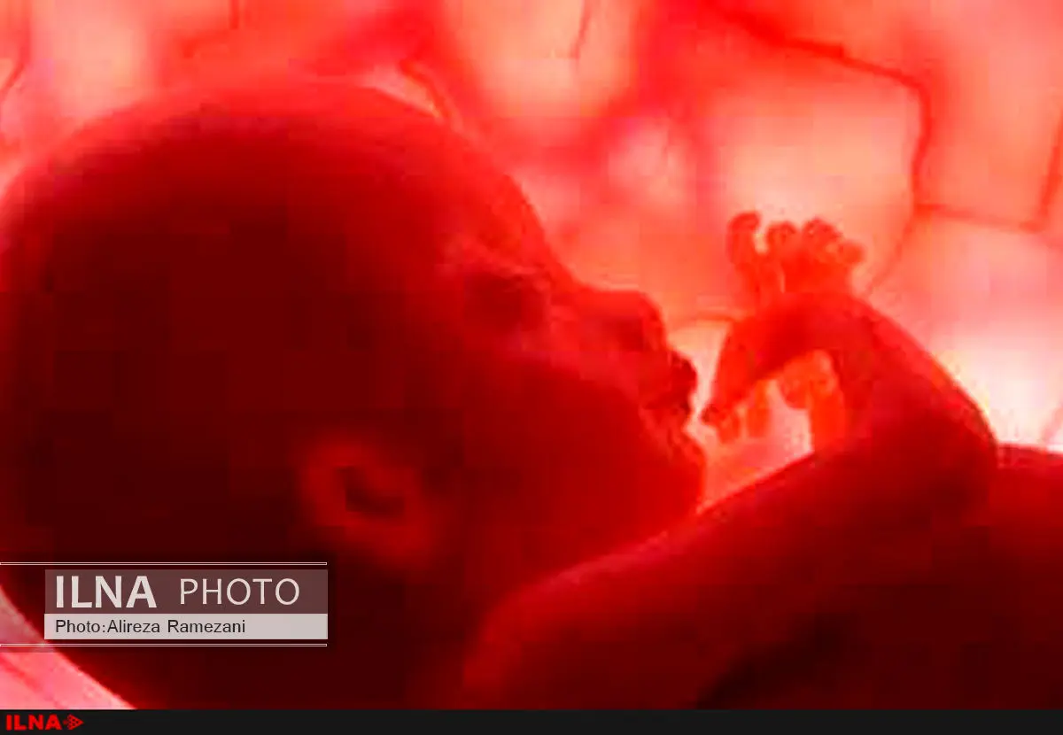 شرایط اقتصادی؛ خانواده‌ها را وادار به سقط جنین می‌کند/تهیه آمار غیرممکن است