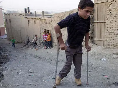 خطر بازگشت فلج اطفال در استان‌های هرمزگان، کرمان و سیستان و بلوچستان