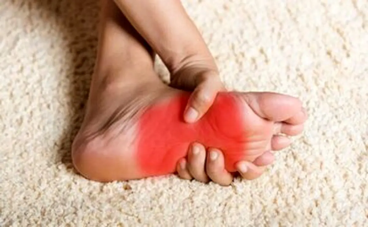 داغی و سوزش کف پا نشانه چیست؟/ با بهترین تسکین‌ دهنده کف پای داغ آشنا شوید 