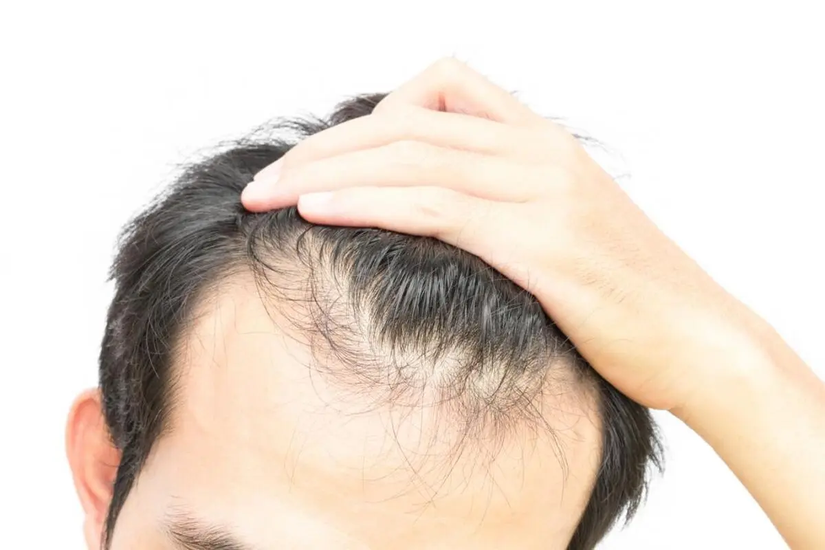 رعایت این نکات از ریزش مو‌های شما جلوگیری می‌کند