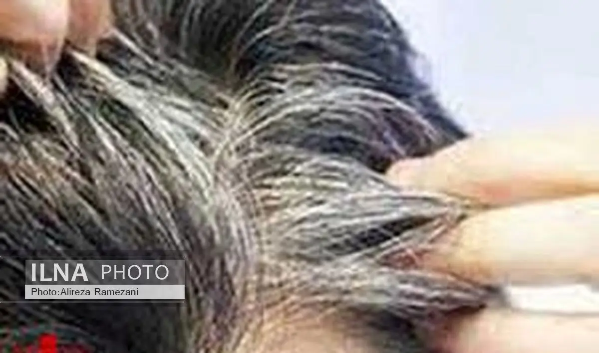 مصرف این غذاها مو را سفید می‌کند 