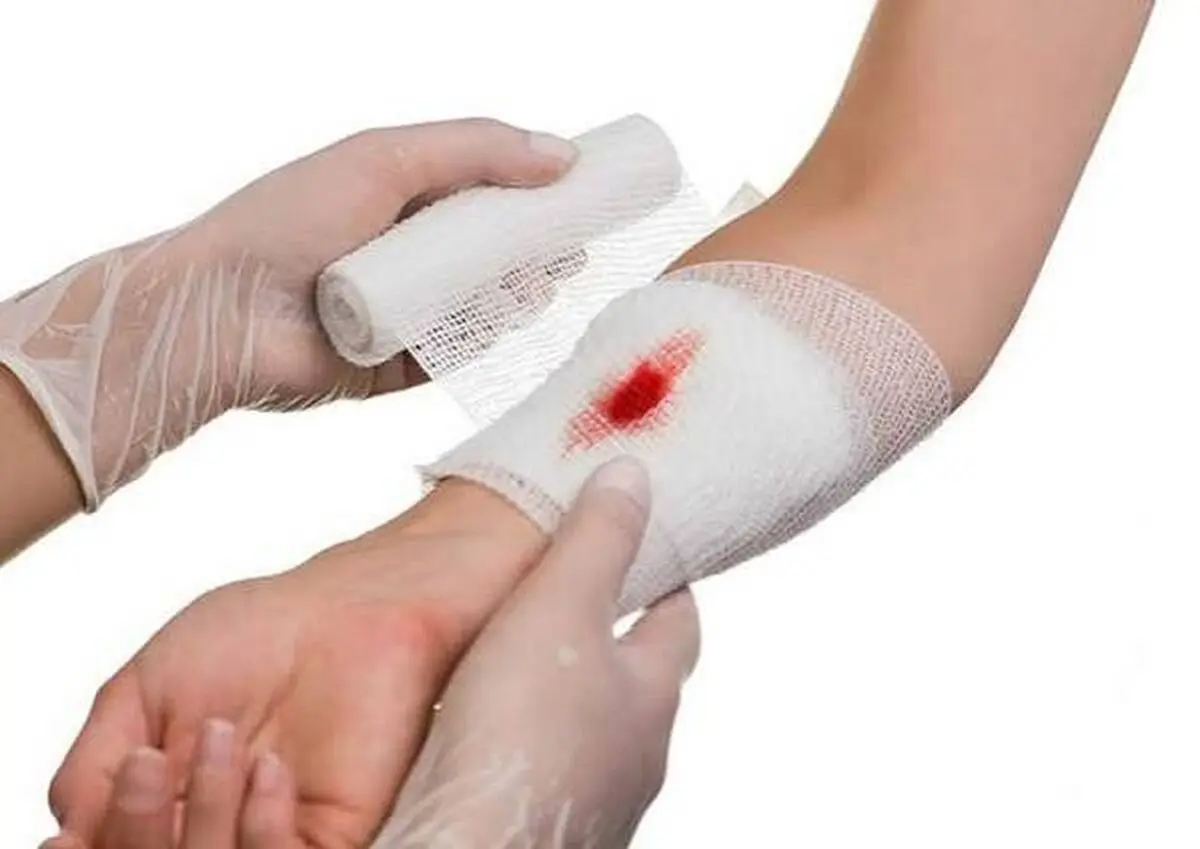 یادگیری این کمک‌های اولیه می تواند یک زندگی را نجات دهد+ فیلم