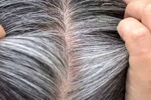 ۷ ترفند علمی برای خداحافظی با موهای سفید