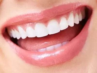 تفاوت کامپوزیت دندان و لمینت چیست؟