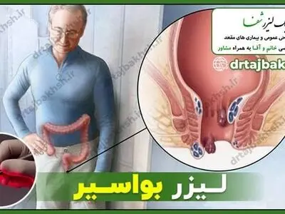 بواسیر یا هموروئید چیست؟