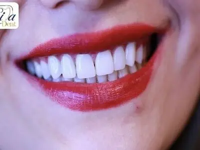 خدمات دندانپزشکی زیبایی