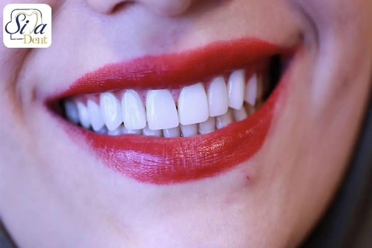 خدمات دندانپزشکی زیبایی