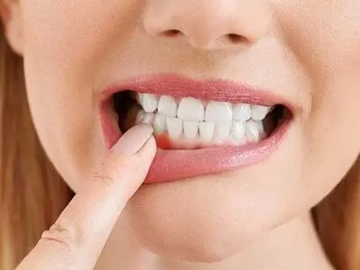 اگر ایمپلنت داریدمراقب این بیماری باشید!