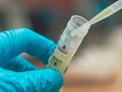 آنچه باید درباره عفونت ادراری بدانید