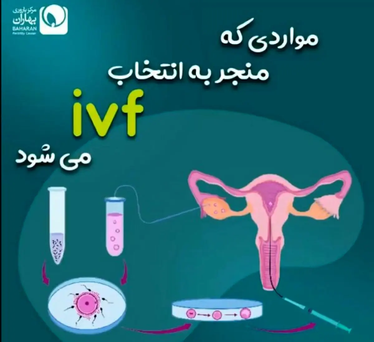 درمان ناباروری به روشivf  چگونه انجام می شود؟