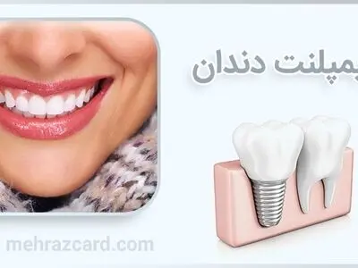 مهراز کارت بهترین کارت تخفیف دندانپزشکی