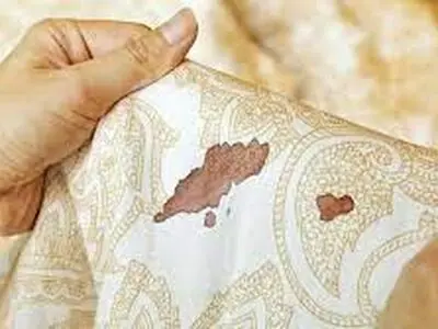 پاک کردن لکه خون خشک شده روی لوازم مختلف