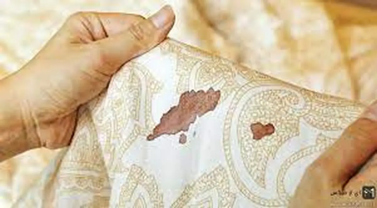 پاک کردن لکه خون خشک شده روی لوازم مختلف