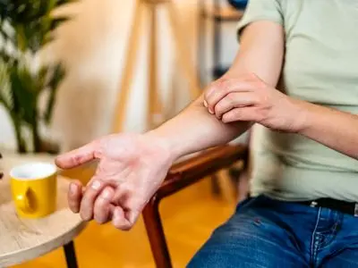 چرا نباید جای نیش حشرات را بخارانیم؟
