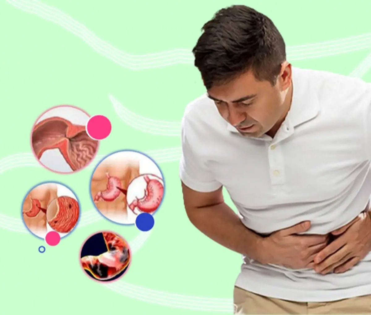 چطور بفهمیم زخم معده داریم؟ 