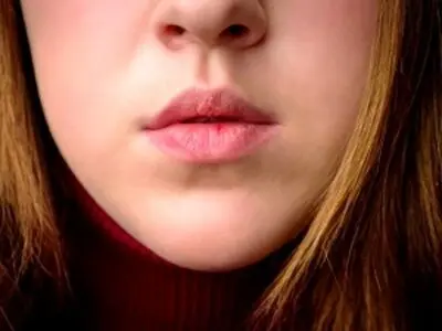 بدترین میوه ها برای کسانی که خشکی لب دارند