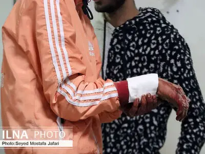 مصدومیت هفت قزوینی بر اثر انفجار مواد محترقه