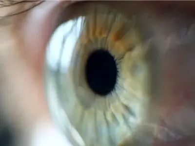 سرماخوردگی چشمی؛ بیماری شایعی که به سرعت اعضای خانواده را درگیر می‌کند