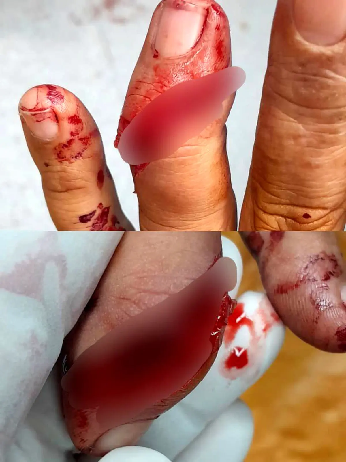 درگیری کارگران نگهبان هفت تپه با سارقان/ قطع دو انگشت یک کارگر 