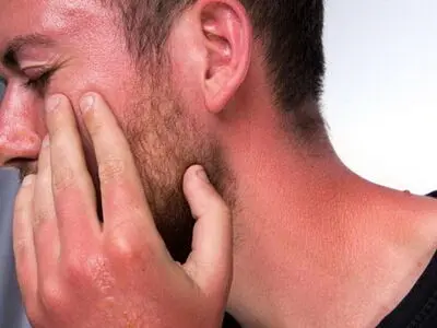 کار‌هایی که پس از ابتلا به آفتاب سوختگی نباید انجام داد