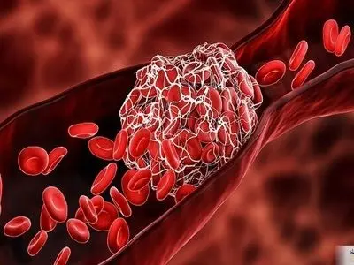 اگر چربی خون بالا دارید بخوانید 