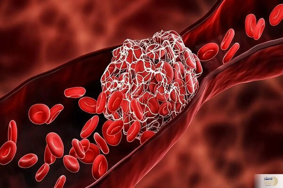 اگر چربی خون بالا دارید بخوانید 