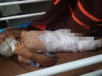 زخمی شدن کودک ۸ ساله سردشتی با حمله سگ‌ها 