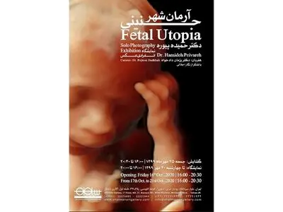 تصاویری از ۲۲ جنین در یک نمایشگاه/ بیان ادراک انسان پیش از تولد