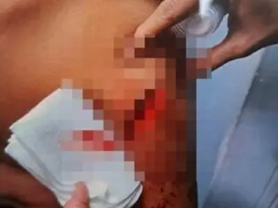 مجروح شدن یک دانش آموز خمامی با چاقوی همکلاسی