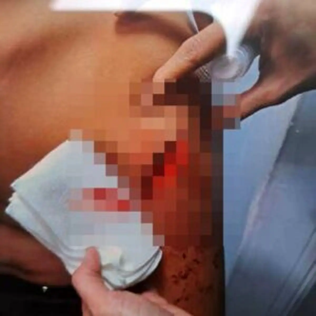 مجروح شدن یک دانش آموز خمامی با چاقوی همکلاسی