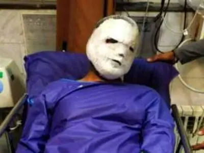 ۱۰۸ مصدوم در پی حوادث چهارشنبه آخرسال در آذربایجان شرقی