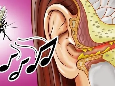 چرا پشه‌ها کنار گوشمان وزوز می‌کنند؟