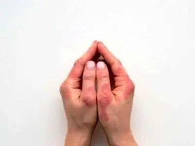 asdasd