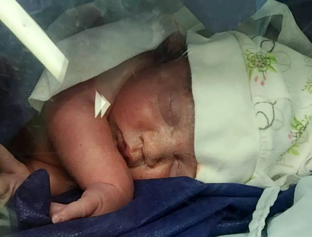 تولد بیش از ۲۰۰ نوزاد، از زمان آغاز جنگ تحمیلی سوم در گیلان