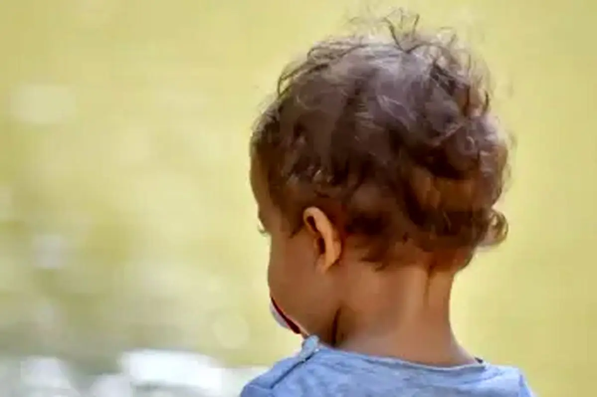 علت سفید شدن موی کودک