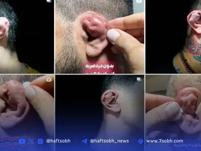 چند می‌گیری گوش بشکنی؟ | درباره پدیده عجیب شکستن عمدی گوش بین جوانان 